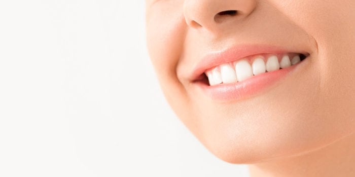 porcelain veneers in Oxnard, California