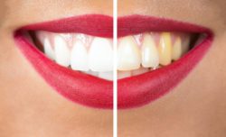 cosmetic dentistry in oxnard, california