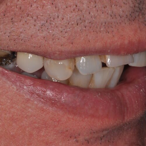 Before dentistry at Beach Cities Dental Group