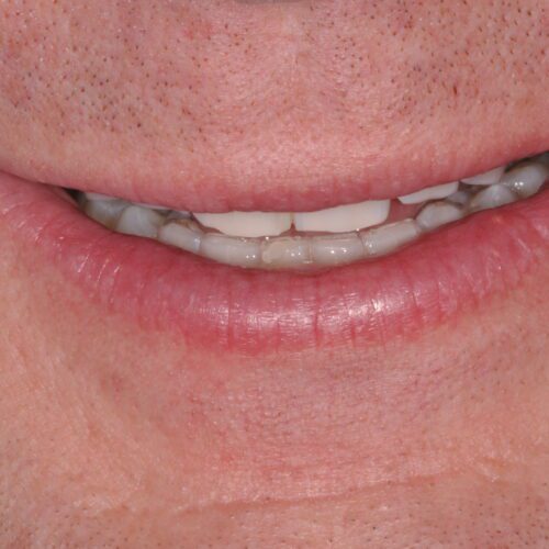 Before dentistry at Beach Cities Dental Group